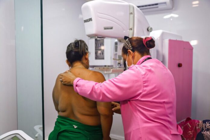 unidade móvel mamografia cancer de mama saúde da mulher